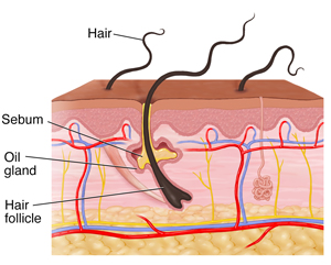 Cross section of skin showing dermis and epidermis.