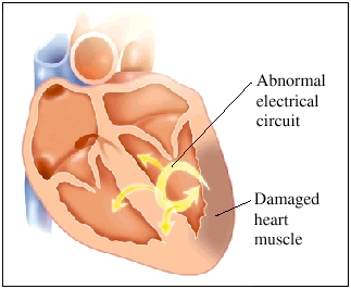 Image of heart