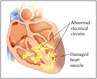 Image of heart