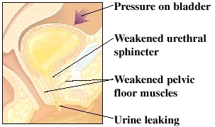 Cutaway view of bladder