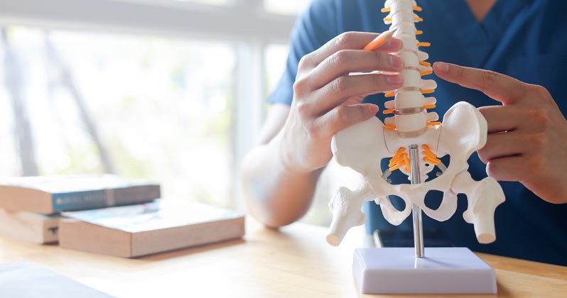 Doctor explains disk issue with model spine